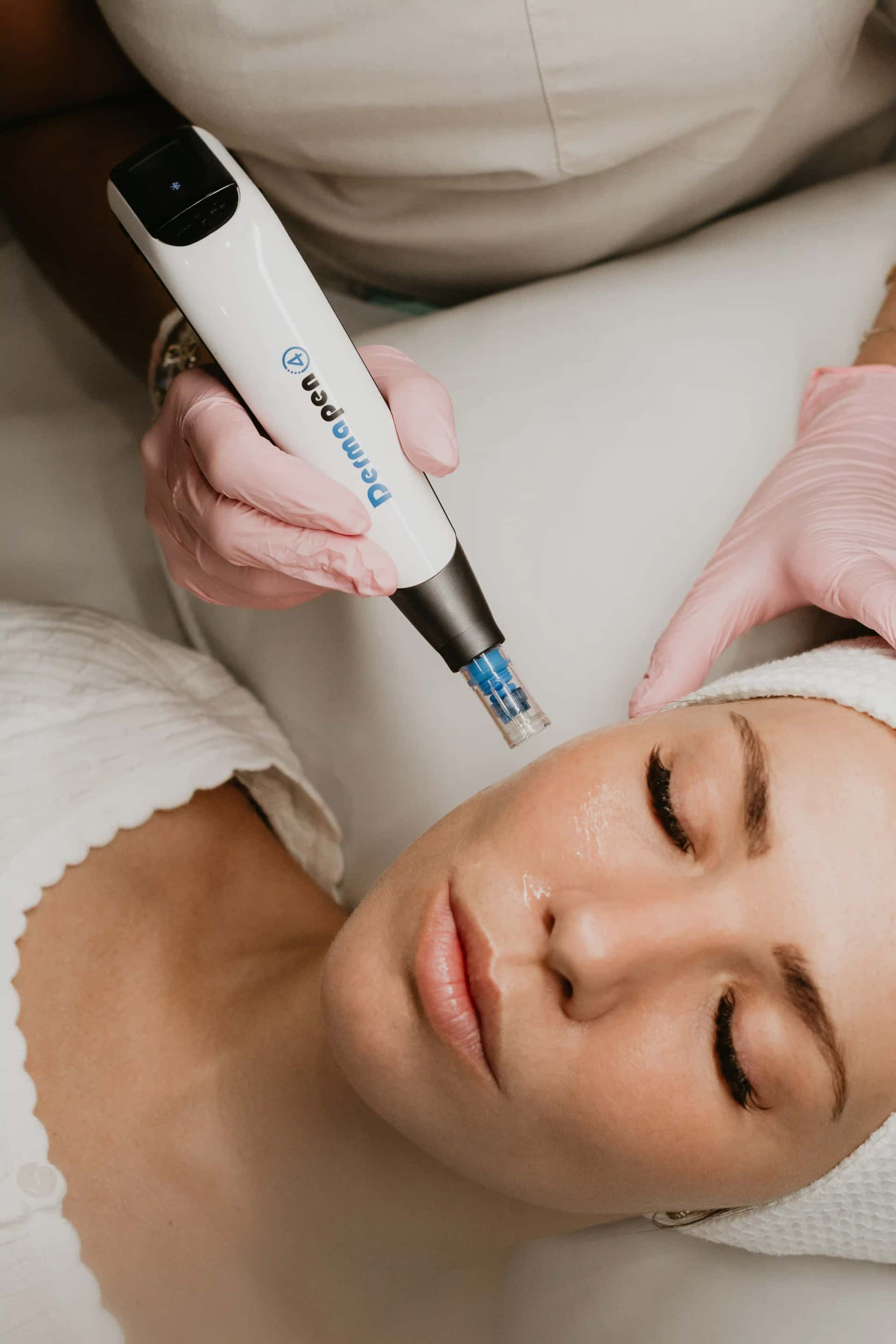 Pourquoi le microneedling DP4 est l'un des meilleurs traitements pour la peau