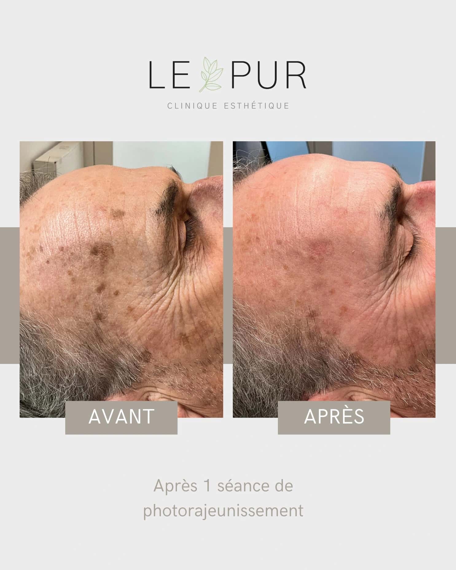 L'automne : le moment parfait pour prendre soin de votre peau